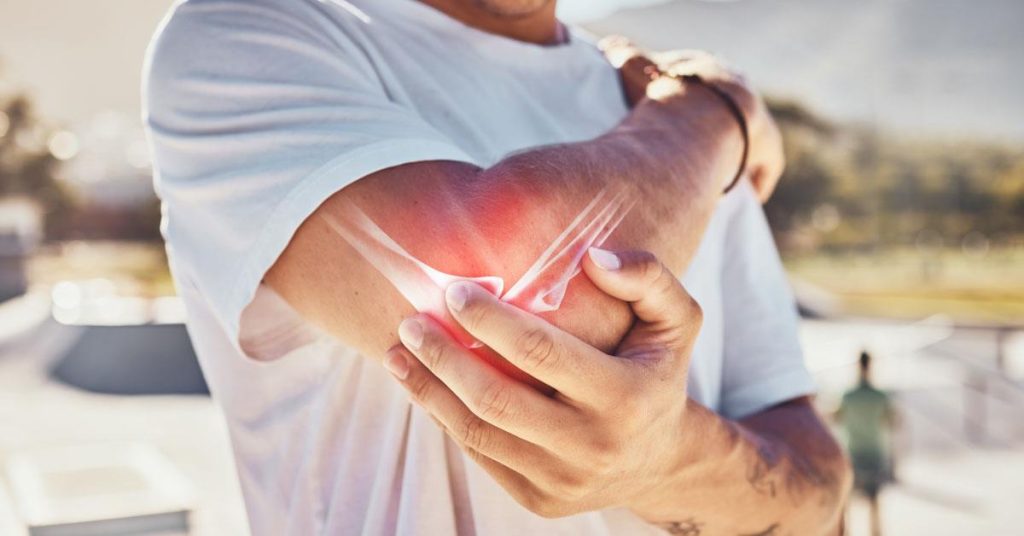 Illustratie van radiuskopfractuur en elleboogklachten met anatomische aanduiding van het getroffen gebied
